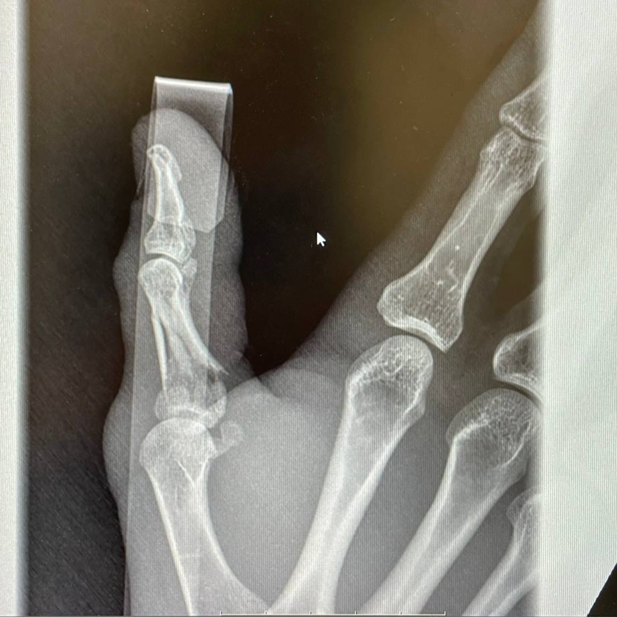 A Ring Your Boner cover